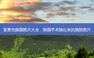 富贵包抽脂图片大全，抽脂手术抽出来的脂肪图片