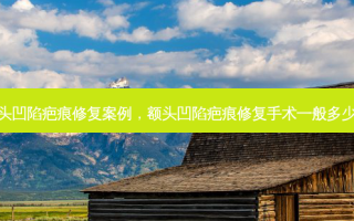 额头凹陷疤痕修复案例，额头凹陷疤痕修复手术一般多少钱