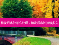 植发后水肿怎么处理，植发后水肿持续多久