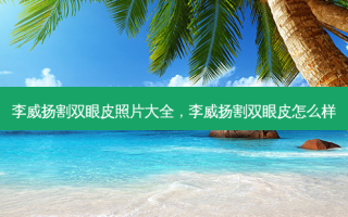 李威扬割双眼皮照片大全，李威扬割双眼皮怎么样