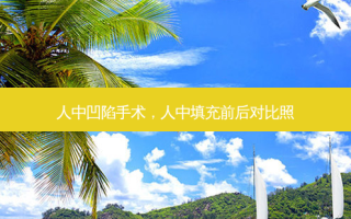 人中凹陷手术，人中填充前后对比照