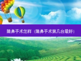 隆鼻手术怎样（隆鼻手术第几台好）