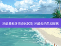牙龈肿和牙周炎的区别 牙龈炎的早期症状
