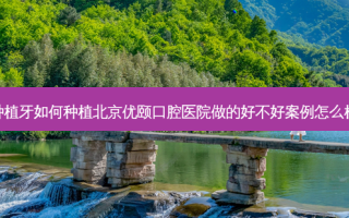 种植牙如何种植北京优颐口腔医院做的好不好案例怎么样