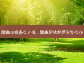隆鼻结痂多久才掉，隆鼻后线结反应怎么办