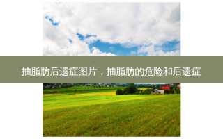 抽脂肪后遗症图片，抽脂肪的危险和后遗症