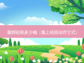 脸部祛斑多少钱（脸上祛斑方式）