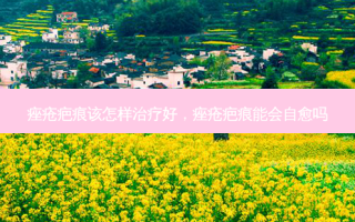痤疮疤痕该怎样治疗好，痤疮疤痕能会自愈吗