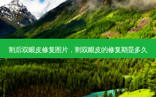 割后双眼皮修复图片，割双眼皮的修复期是多久