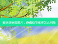 姜疙瘩疤痕图片，疤痕结节疙瘩怎么消除
